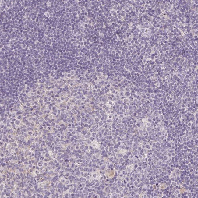 PPFIA4 Antibody in Immunohistochemistry (IHC)