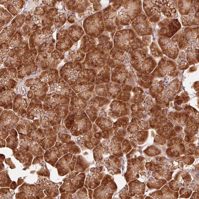 MRPL16 Antibody in Immunohistochemistry (Paraffin) (IHC (P))