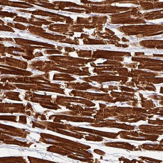 NT5C1A Antibody in Immunohistochemistry (IHC)