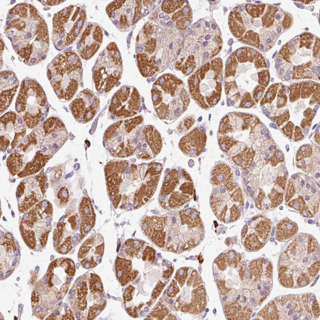 PNPLA5 Antibody in Immunohistochemistry (Paraffin) (IHC (P))