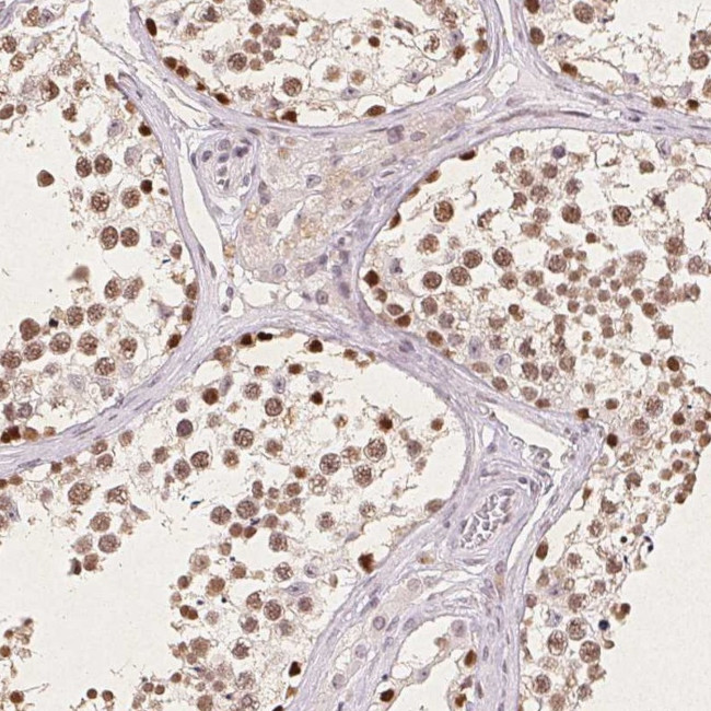 CCDC138 Antibody in Immunohistochemistry (Paraffin) (IHC (P))