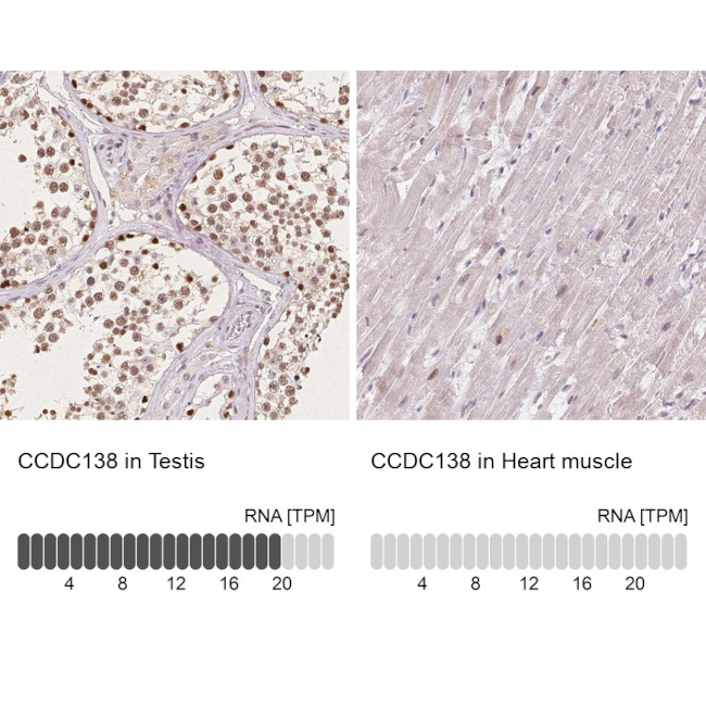 CCDC138 Antibody in Immunohistochemistry (IHC)