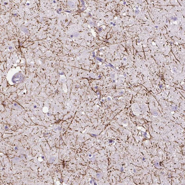 G7C Antibody in Immunohistochemistry (Paraffin) (IHC (P))