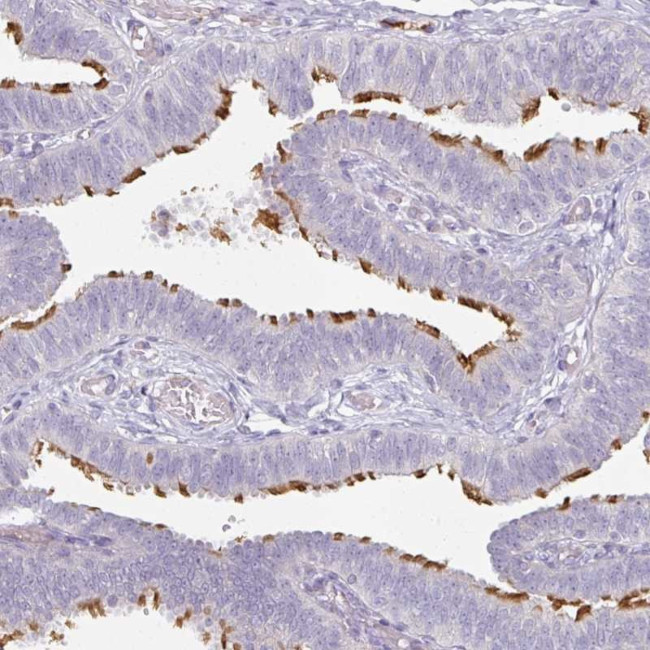 FHAD1 Antibody in Immunohistochemistry (Paraffin) (IHC (P))