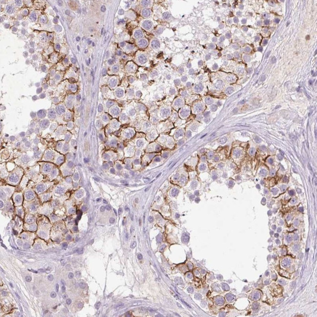 FNDC7 Antibody in Immunohistochemistry (Paraffin) (IHC (P))