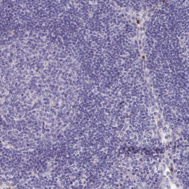 TAS2R38 Antibody in Immunohistochemistry (Paraffin) (IHC (P))