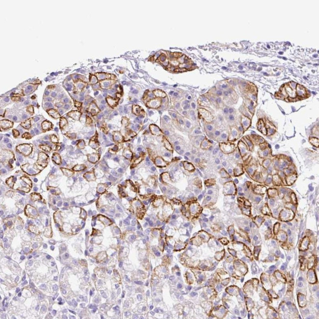TARM1 Antibody in Immunohistochemistry (Paraffin) (IHC (P))