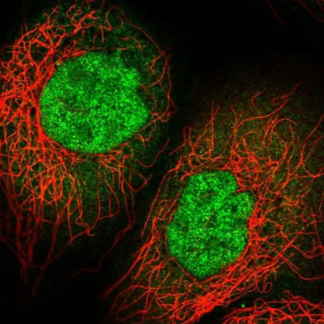 IMUP Antibody in Immunocytochemistry (ICC/IF)