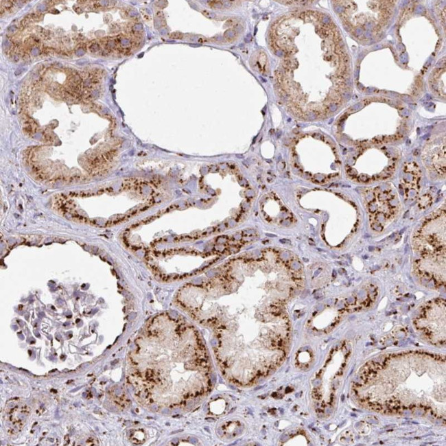DIPA Antibody in Immunohistochemistry (Paraffin) (IHC (P))