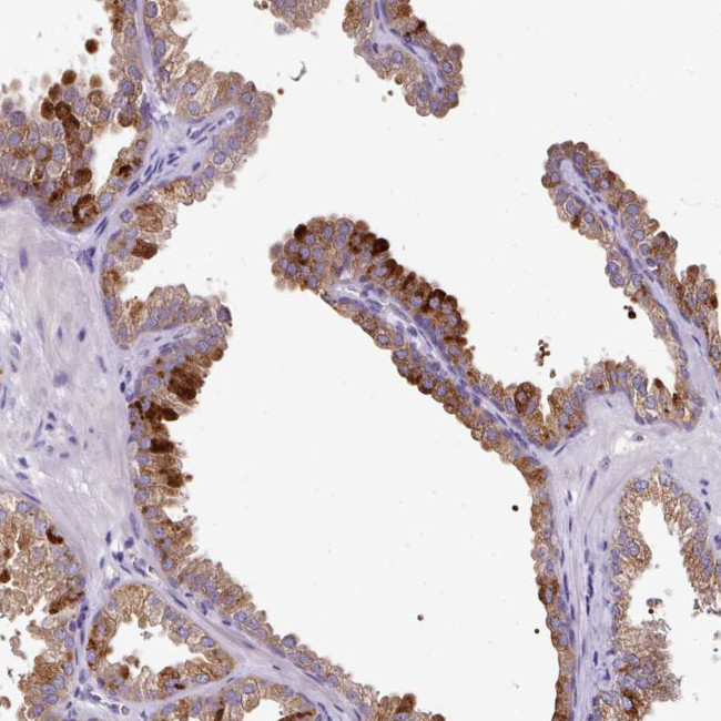 SKIV2L Antibody in Immunohistochemistry (Paraffin) (IHC (P))