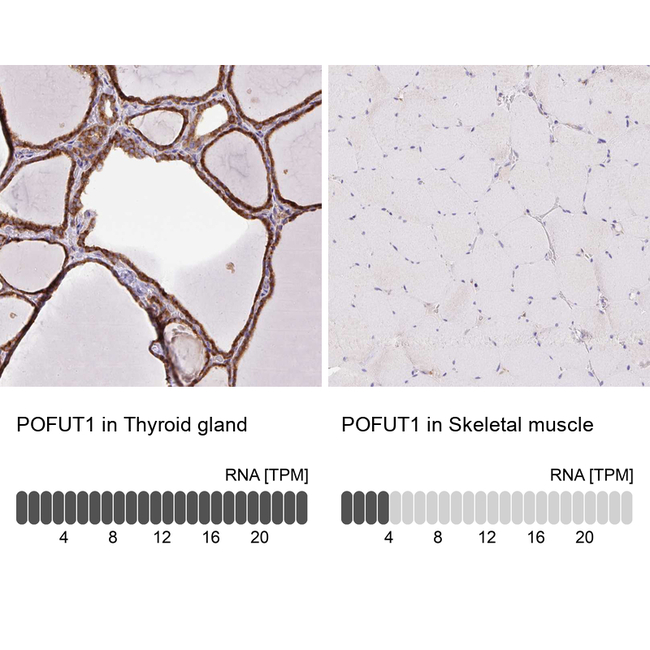 POFUT1 Antibody in Immunohistochemistry (Paraffin) (IHC (P))