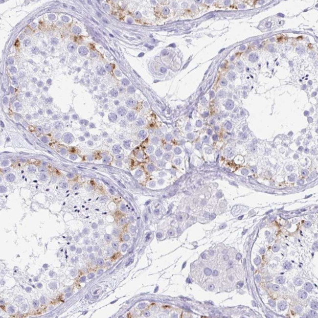 TEX19 Antibody in Immunohistochemistry (Paraffin) (IHC (P))