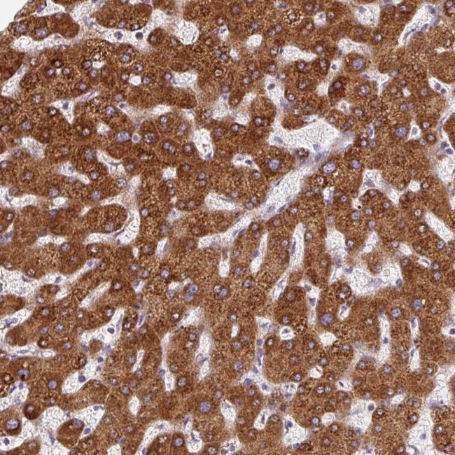 PTCHD2 Antibody in Immunohistochemistry (Paraffin) (IHC (P))