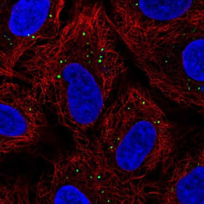Krt222 Antibody in Immunocytochemistry (ICC/IF)