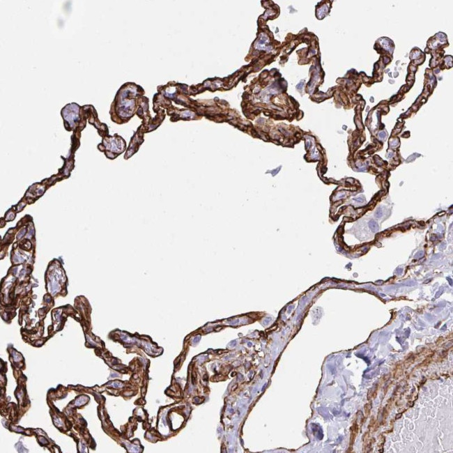 IGSF23 Antibody in Immunohistochemistry (Paraffin) (IHC (P))