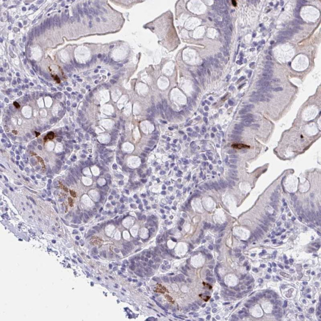 FBXL22 Antibody in Immunohistochemistry (Paraffin) (IHC (P))