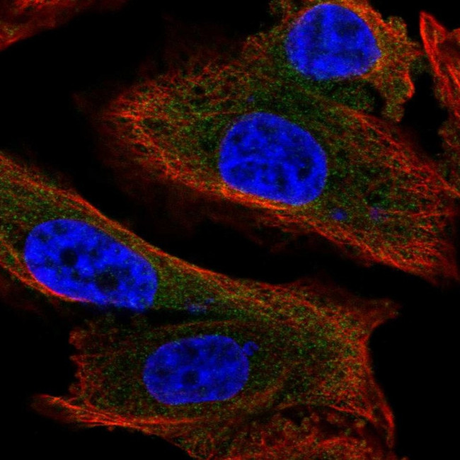 MAP1S Antibody in Immunocytochemistry (ICC/IF)