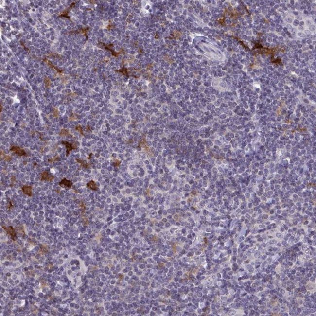 SNX11 Antibody in Immunohistochemistry (Paraffin) (IHC (P))