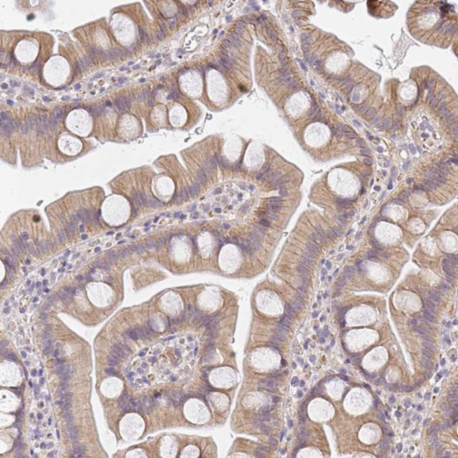 SLC35B3 Antibody in Immunohistochemistry (Paraffin) (IHC (P))