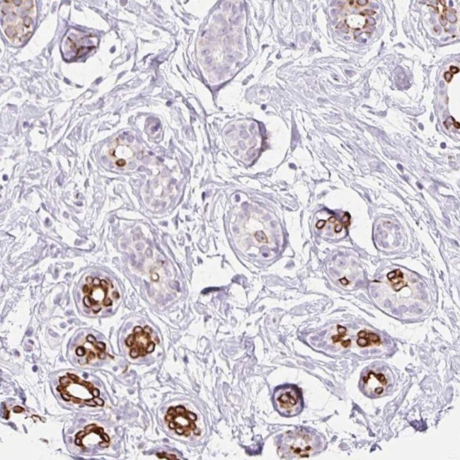 IRX2 Antibody in Immunohistochemistry (IHC)