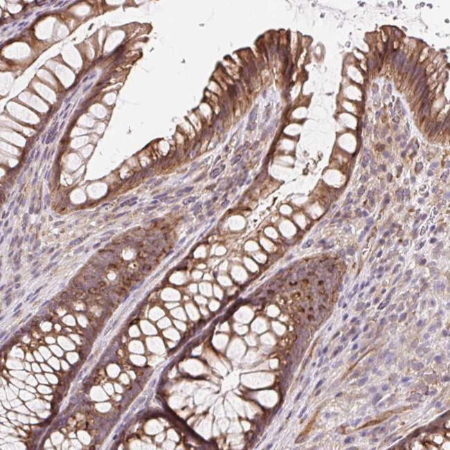 LYPD5 Antibody in Immunohistochemistry (Paraffin) (IHC (P))