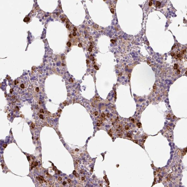 TDRD15 Antibody in Immunohistochemistry (Paraffin) (IHC (P))