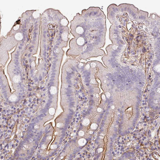 B3GALT5 Antibody in Immunohistochemistry (Paraffin) (IHC (P))