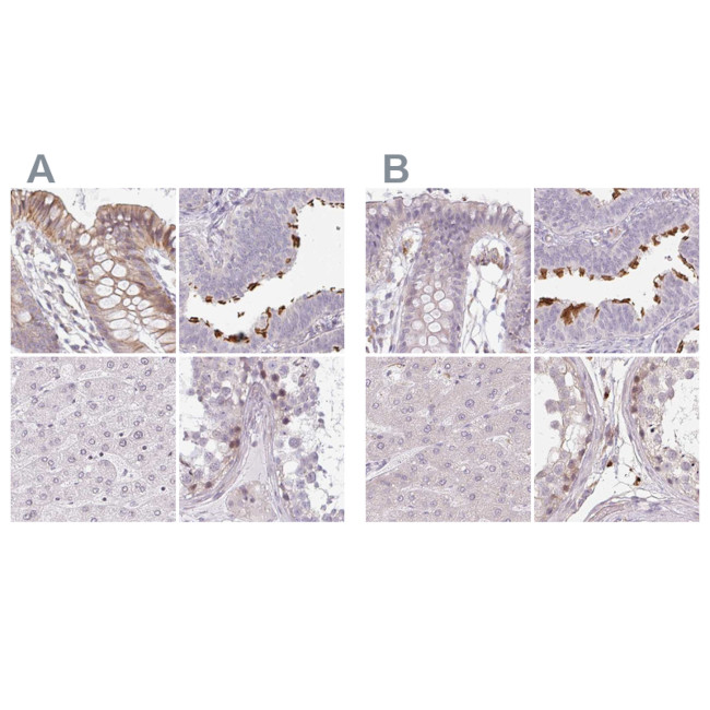 TMEM237 Antibody in Immunohistochemistry (IHC)