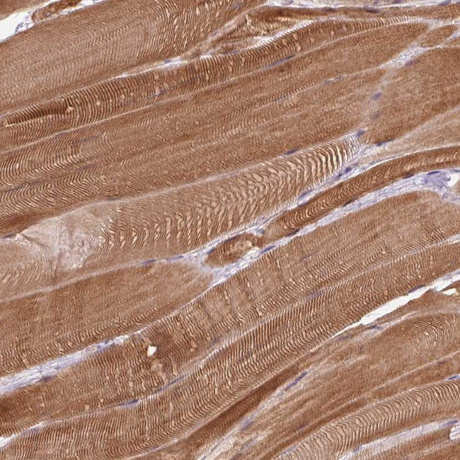 FAM65C Antibody in Immunohistochemistry (Paraffin) (IHC (P))