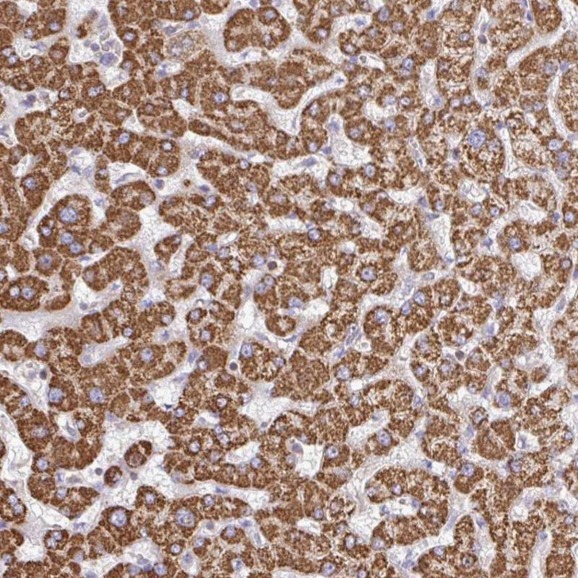 TTC39B Antibody in Immunohistochemistry (Paraffin) (IHC (P))