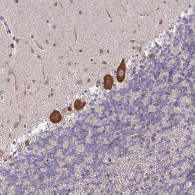 LARP1 Antibody in Immunohistochemistry (Paraffin) (IHC (P))