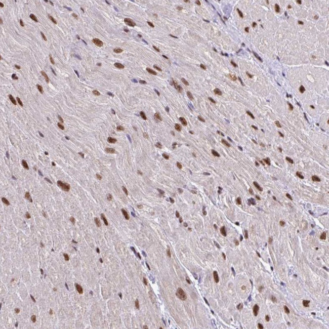 ABCA9 Antibody in Immunohistochemistry (Paraffin) (IHC (P))