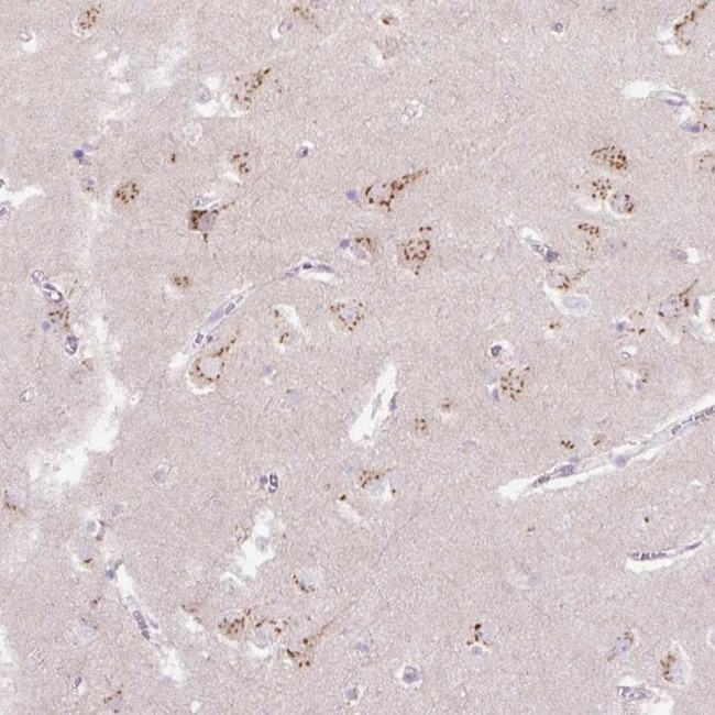 ABR Antibody in Immunohistochemistry (Paraffin) (IHC (P))