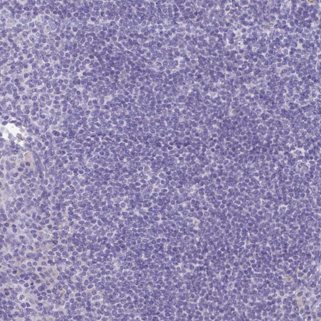 Carbonic Anhydrase X Antibody in Immunohistochemistry (Paraffin) (IHC (P))