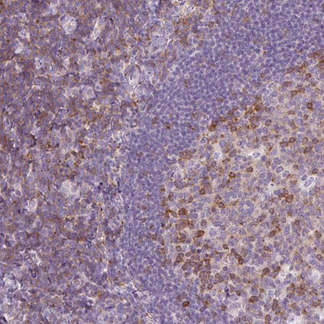 TIGD2 Antibody in Immunohistochemistry (Paraffin) (IHC (P))