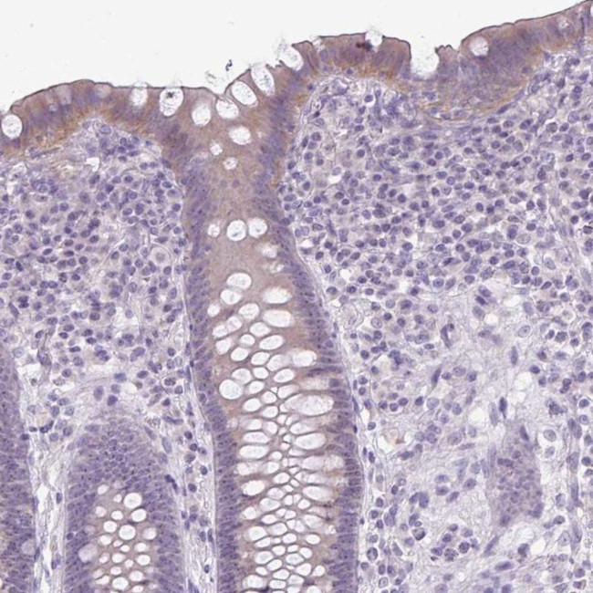 NHSL2 Antibody in Immunohistochemistry (IHC)