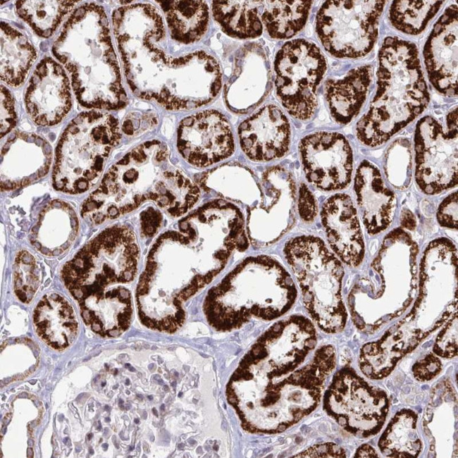 DZIP1 Antibody in Immunohistochemistry (Paraffin) (IHC (P))