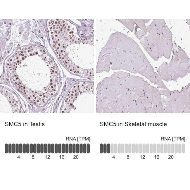 SMC5 Antibody