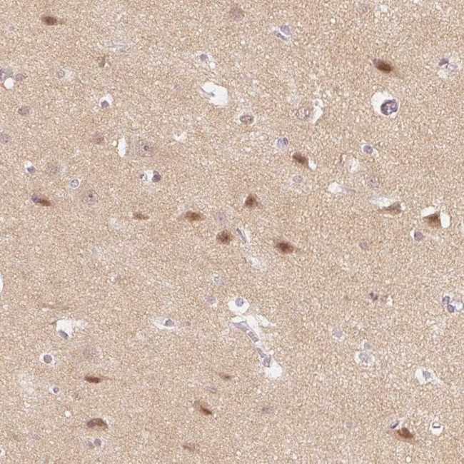 DNAJC6 Antibody in Immunohistochemistry (Paraffin) (IHC (P))