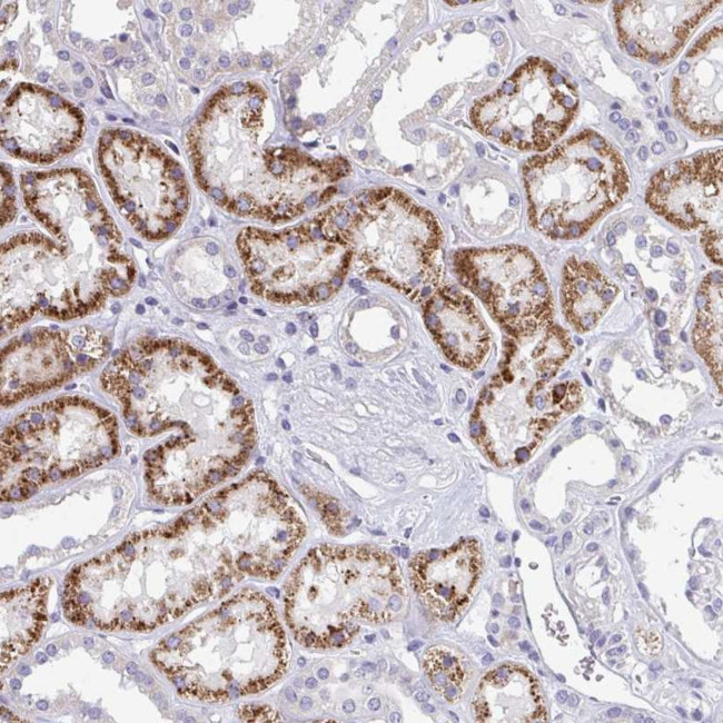 EIF1AD Antibody in Immunohistochemistry (Paraffin) (IHC (P))