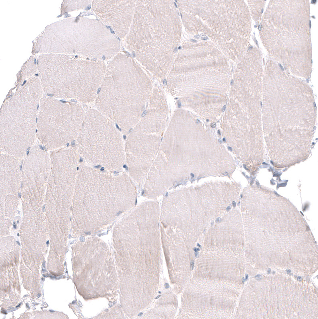 FOCAD Antibody in Immunohistochemistry (Paraffin) (IHC (P))