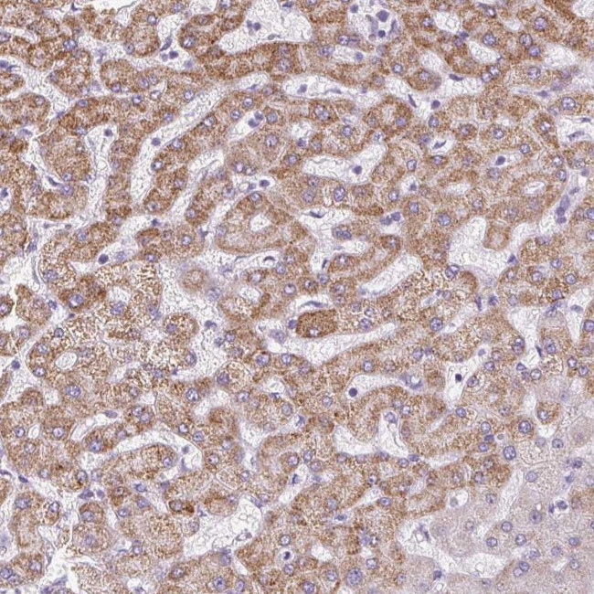 TMEM170A Antibody in Immunohistochemistry (Paraffin) (IHC (P))