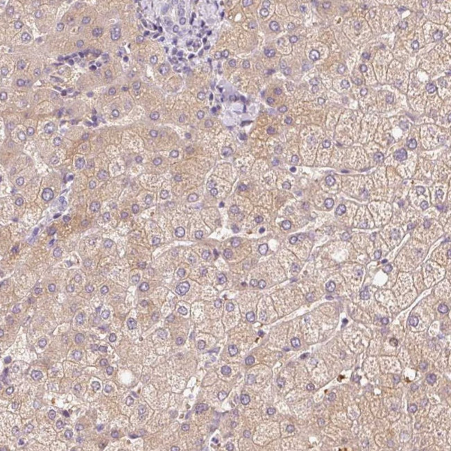 CMTM8 Antibody in Immunohistochemistry (Paraffin) (IHC (P))