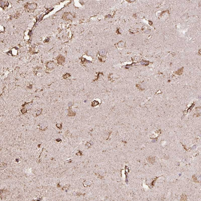LRTM2 Antibody in Immunohistochemistry (Paraffin) (IHC (P))