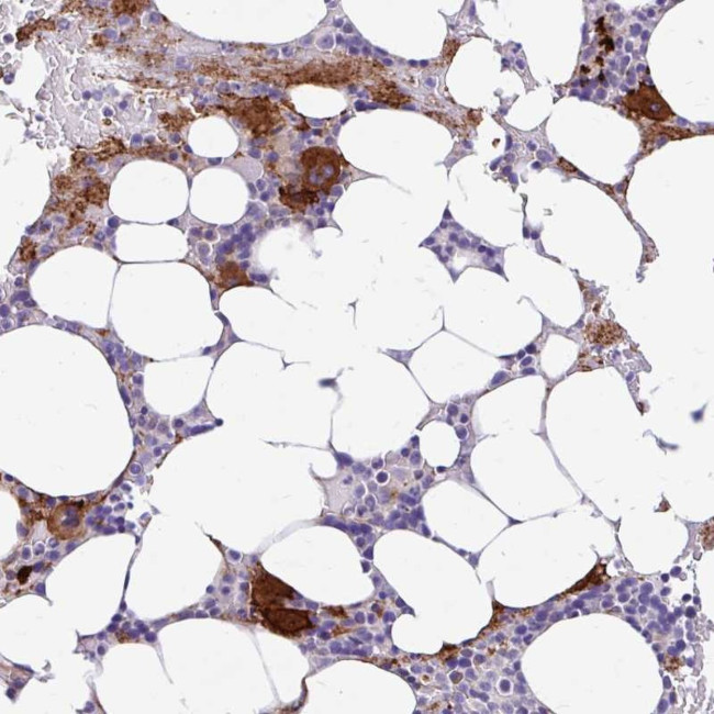 ESPNL Antibody in Immunohistochemistry (Paraffin) (IHC (P))