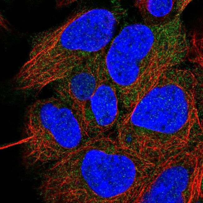 CCDC28A Antibody in Immunocytochemistry (ICC/IF)