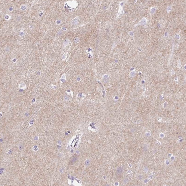 PRRT1 Antibody in Immunohistochemistry (Paraffin) (IHC (P))