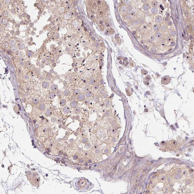 TMEM151B Antibody in Immunohistochemistry (Paraffin) (IHC (P))
