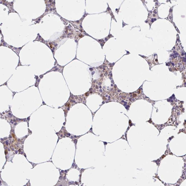 ABCB10 Antibody in Immunohistochemistry (Paraffin) (IHC (P))