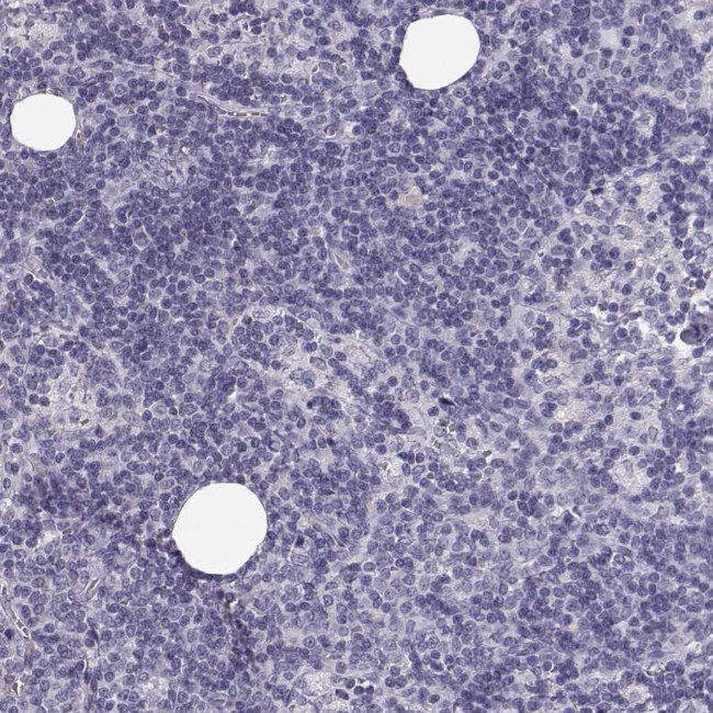 Cytokeratin 31 Antibody in Immunohistochemistry (Paraffin) (IHC (P))
